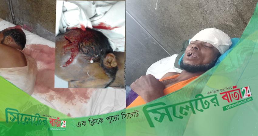 জকিগঞ্জে প্রতিপক্ষের আহত বৃদ্ধ ওসমানী হাসপাতালে জীবন-মৃত্যুর সন্ধিক্ষণে