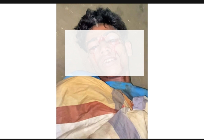 গোয়াইনঘাটে নৌকা চুরির অভিযোগে যুবকের চোখ উপড়ে ফেললো দুর্বৃত্তরা