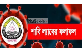 করোনা: শাবিতে ১৬৩ জন শনাক্ত