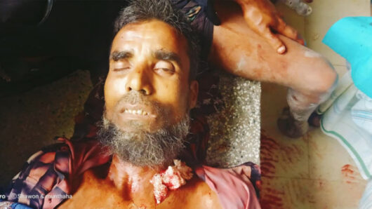 সিলেটে মেয়েকে ধ.র্ষ.ণে.র অভিযোগ করায় বাবাকে কুপিয়ে খু/ন